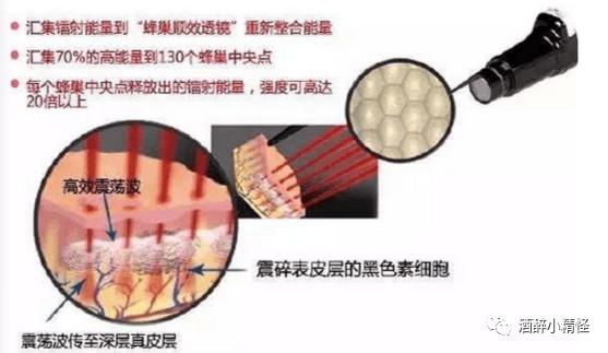 皮秒超皮秒激光區(qū)別,皮秒超皮秒激光區(qū)別與數(shù)據(jù)整合實(shí)施解析,全面計(jì)劃執(zhí)行_版輿27.16.78