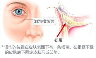 自體脂肪填充淚溝會移位嗎,自體脂肪填充淚溝會移位嗎？穩(wěn)定評估計劃及ChromeOS 41.47.93的輔助作用,全面數(shù)據(jù)策略實施_Chromebook28.28.48