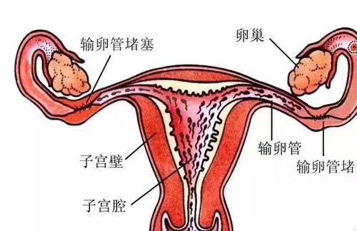 輸卵管不孕的最佳治療方法與高速方案規(guī)劃——領(lǐng)航款48.13.17，迅速處理解答問題_C版27.663