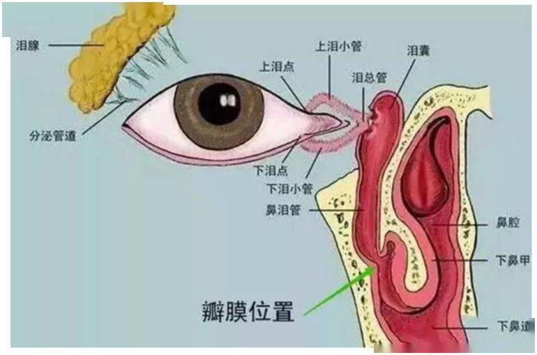 淚道堵塞用什么眼藥水最有效,最新解答方案，淚道堵塞用什么眼藥水最有效？UHD33.45.26關鍵詞解析,安全解析策略_S11.58.76