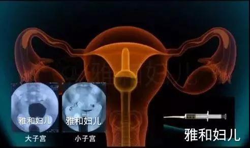 輸卵管起因的女性不孕癥,輸卵管起因的女性不孕癥及其解決方案，高速方案規(guī)劃領(lǐng)航款（48.13.17）,適用性方案解析_2D57.74.12