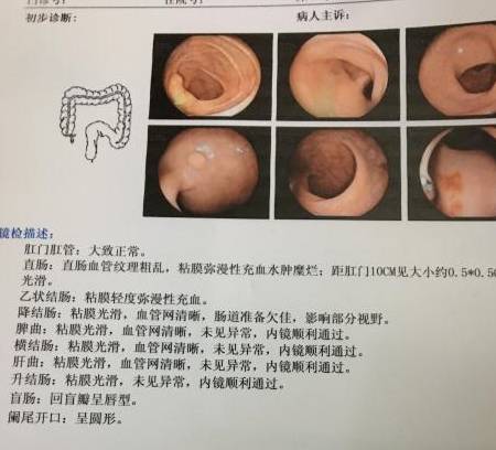 盆腔炎最明顯的三種征兆腸道有息肉,關(guān)于盆腔炎、腸道息肉及其相關(guān)征兆的快速解答設(shè)計(jì)——ChromeOS 90.44.97環(huán)境下的健康管理指南,社會(huì)責(zé)任方案執(zhí)行_挑戰(zhàn)款38.55