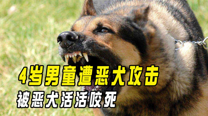 遭惡犬襲擊4歲男童或需全身?yè)Q血